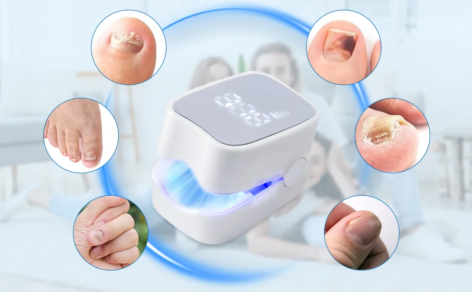 Appareil Anti-Mycose – Solution Complète pour Ongles et Peau