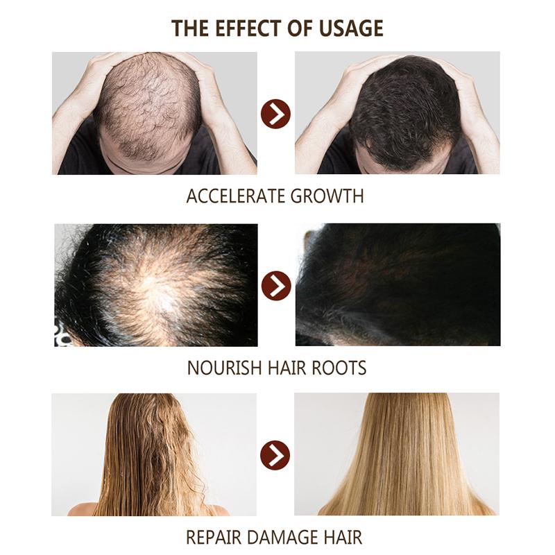 Spray du Gingembre 7days