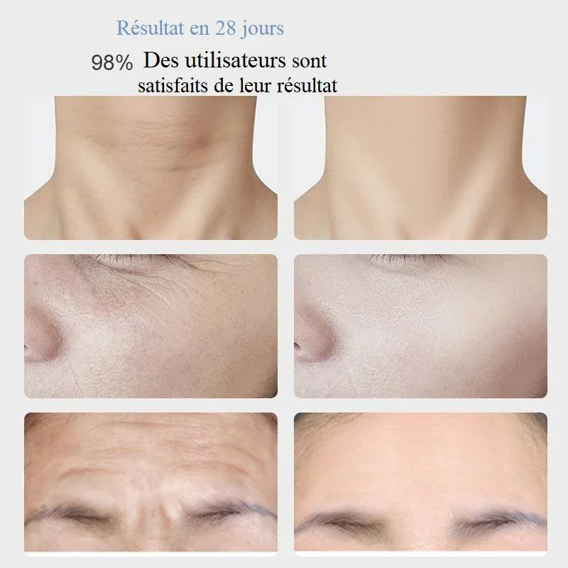 Masseur Facial Électrique