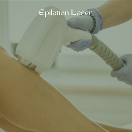 L’épilation laser