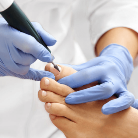 Pédicure Médicale