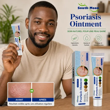 South Moon Psoriasis Ointment