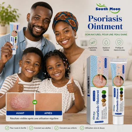South Moon Psoriasis Ointment 2