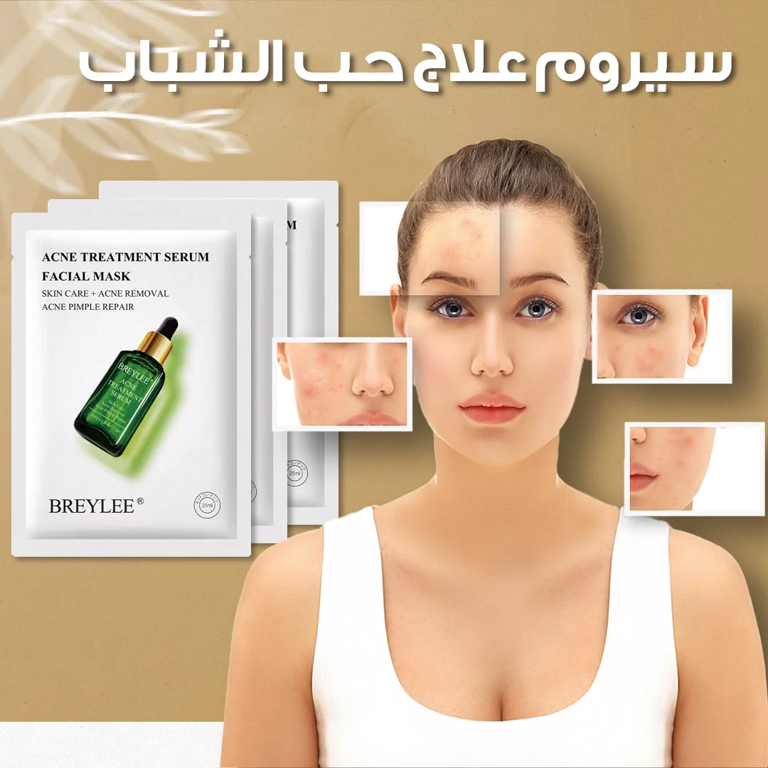 مصل معالجة حب الشباب بشجرة الشاي