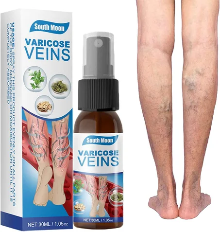 📢 profitez d'une remise de 30 %  🎉🎉  SOUTH MOON-Spray Pour Les Varices.🎁🎁