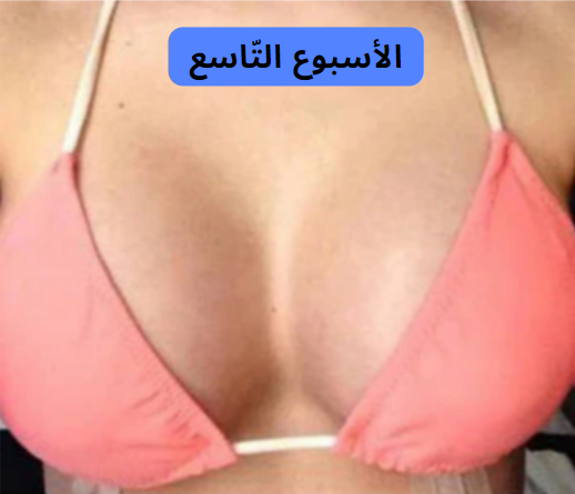 stores/8ad83b5be048c518ca87f1eef3053e2b/products/25OZIfpJptelwkkOTWlqx7iQ7UsXpnXQUeNvSK2F.png