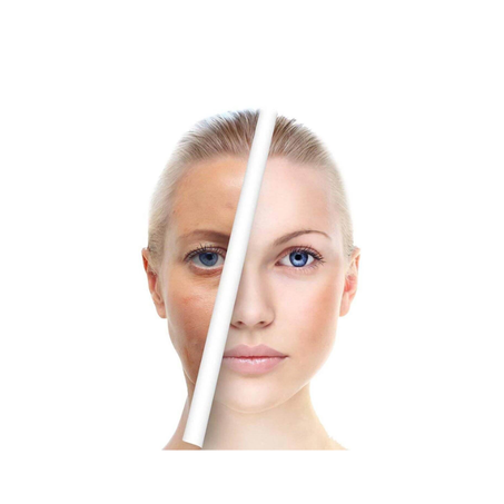 Skin Care
