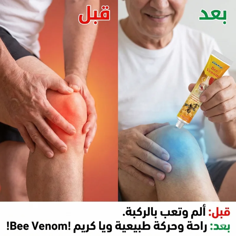 عرض قطعتين Bee Venom