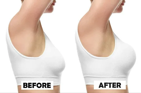 Breast Lift Tape Invisible Bra