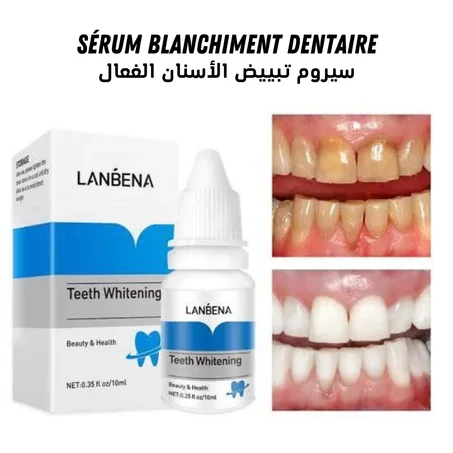سيروم تبييض الأسنان Sérum blanchiment dentaire