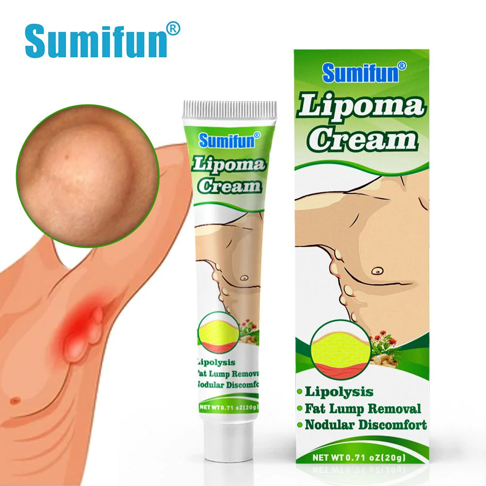 La crème Lipoma peut dissoudre les graisses