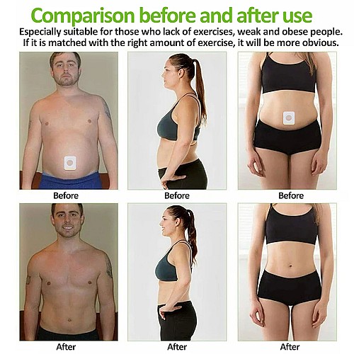 🏋️‍♀️💊 Slim Patch - منتج التخسيس السريع لتخفيض الوزن 🌟🌿