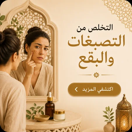 التصبغات والبقع