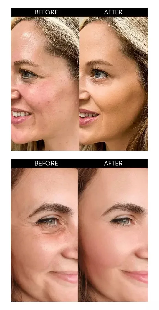 مجموعة سيروم الكولاجين للوجه - المملكة العربية السعودية