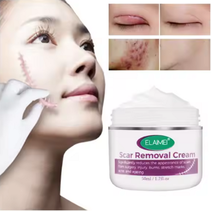 stores/8ff0cc43fa21e2250ff37af6289cf167/products/UG1sPRGfJzIC8Uaui2bGPMb4UJ2R31zEH7DNX6hx.png