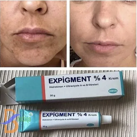كريم تبيض الوجه والمناطق الحساسة