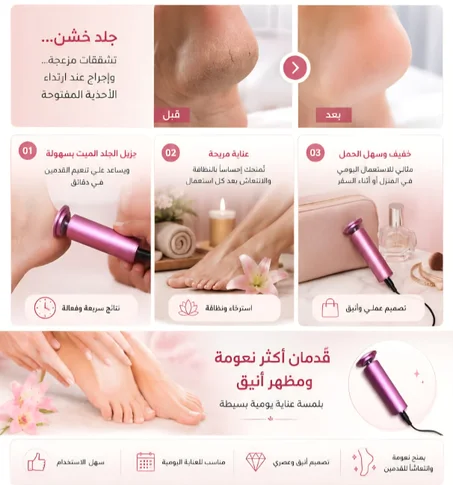آلة إزالة الجلد الميت والخشونة من القدمين