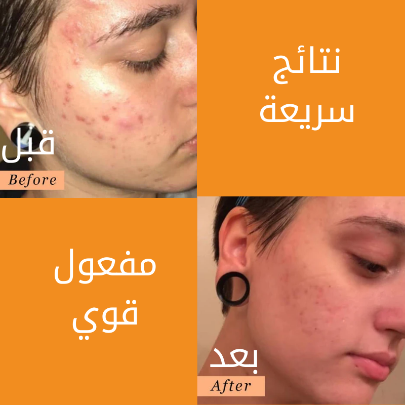 بانوكسيل - غسول للوجه +توصيل مجاني