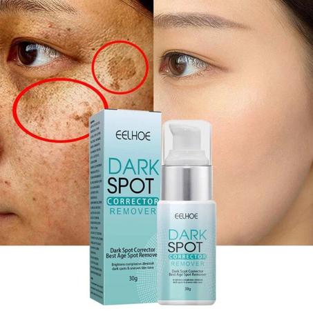 كريم تبييض النمش و مزيل البقع الداكنة للعناية بالبشرة والترطيب والتفتيح ومكافحة الشيخوخة وجمال الوجه