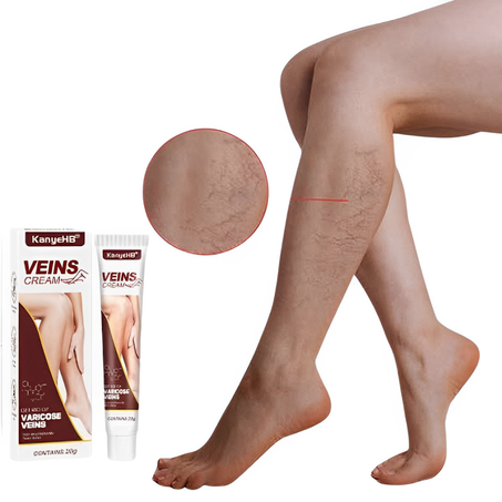 كريم لتخفيف الدوالي