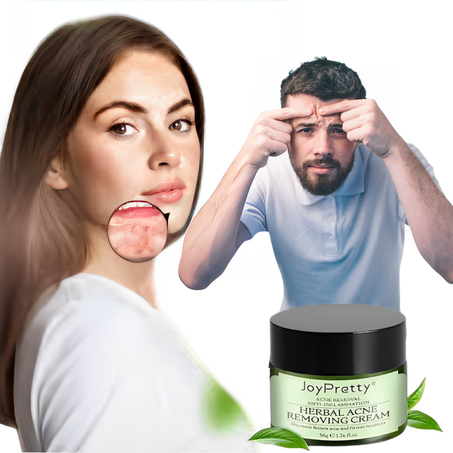 كريم وجه لعلاج حب الشباب،