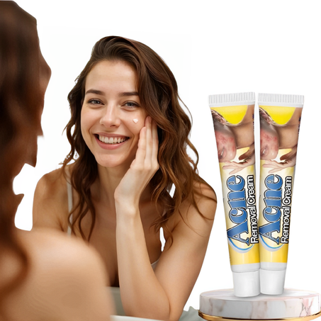 كريم حب الشباب – ACNE REMOVAL CREAM