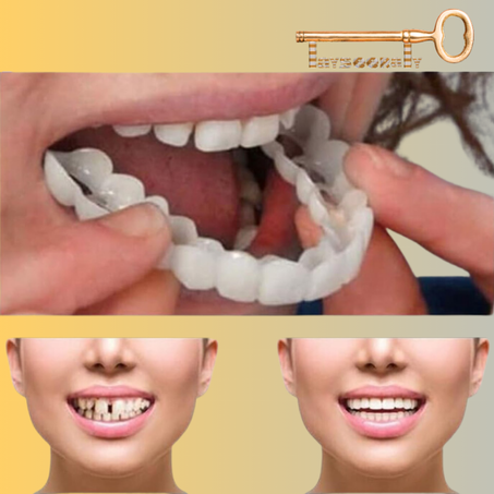 غشاء الأسنان العلوية