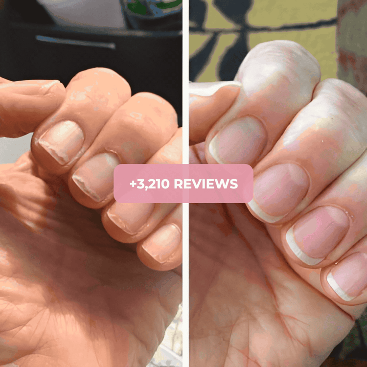 Крепкие и Длинные Ногти Всего за 7 Дней — Натуральная Сыворотка NailRegen 💅