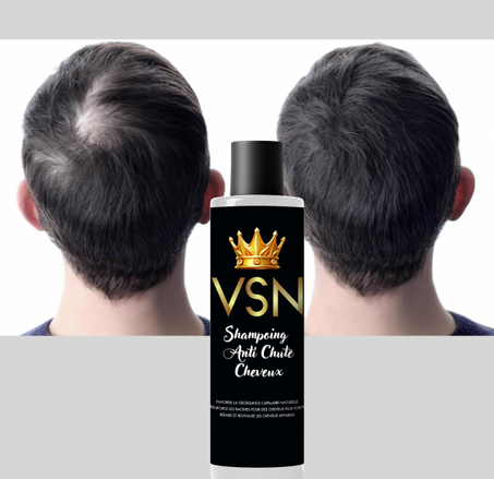 شامبو VSN-من الصلع إلى الكثافة خلال شهور