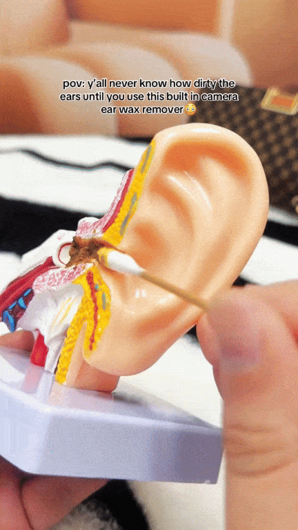 Nettoyeur dâoreille visuel