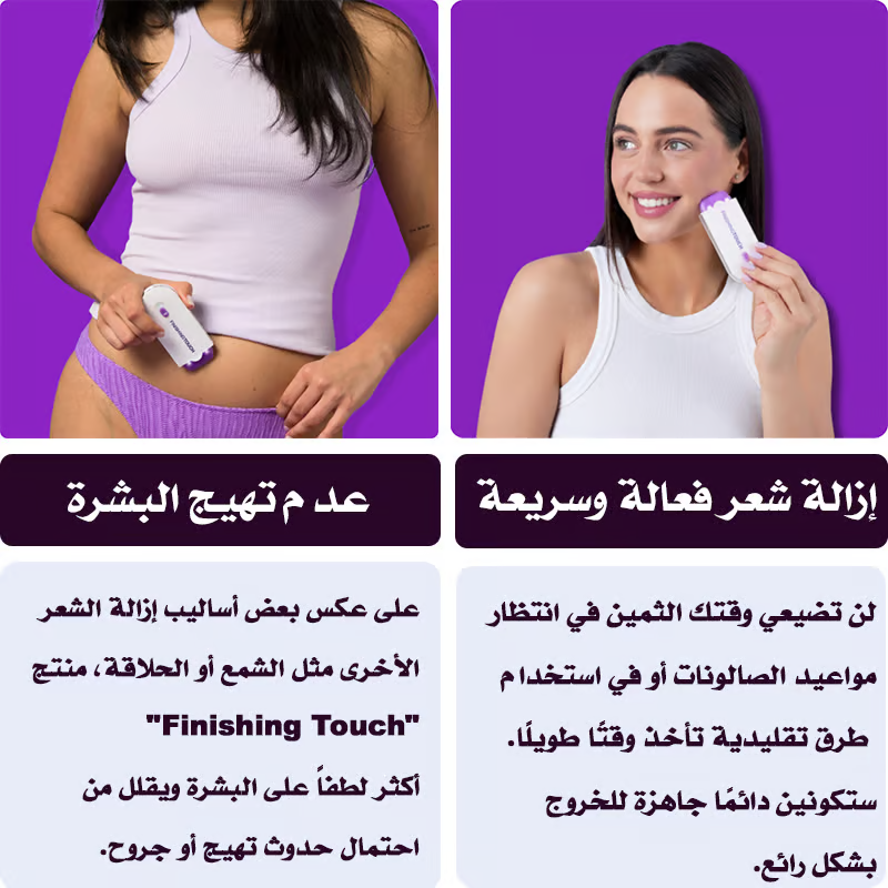 Finishing Touch – لإزالة الشعر بسهولة وبدون ألم! 6l9t2T2dbNS9iYClcEgPNrIMv7SMWfVNV9kyiAkP