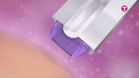 Finishing Touch – لإزالة الشعر بسهولة وبدون ألم! 8cr8FmhCfDaTkml2MnR9sX2WgEEQO8091K2vdz1L