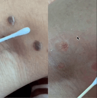 المرهم الاول في العالم لازالة الثآليل🌟 (نسخة) D1xifj8dvREBm2mAa0aLDIWO72NaWrXhAFBl7ECW