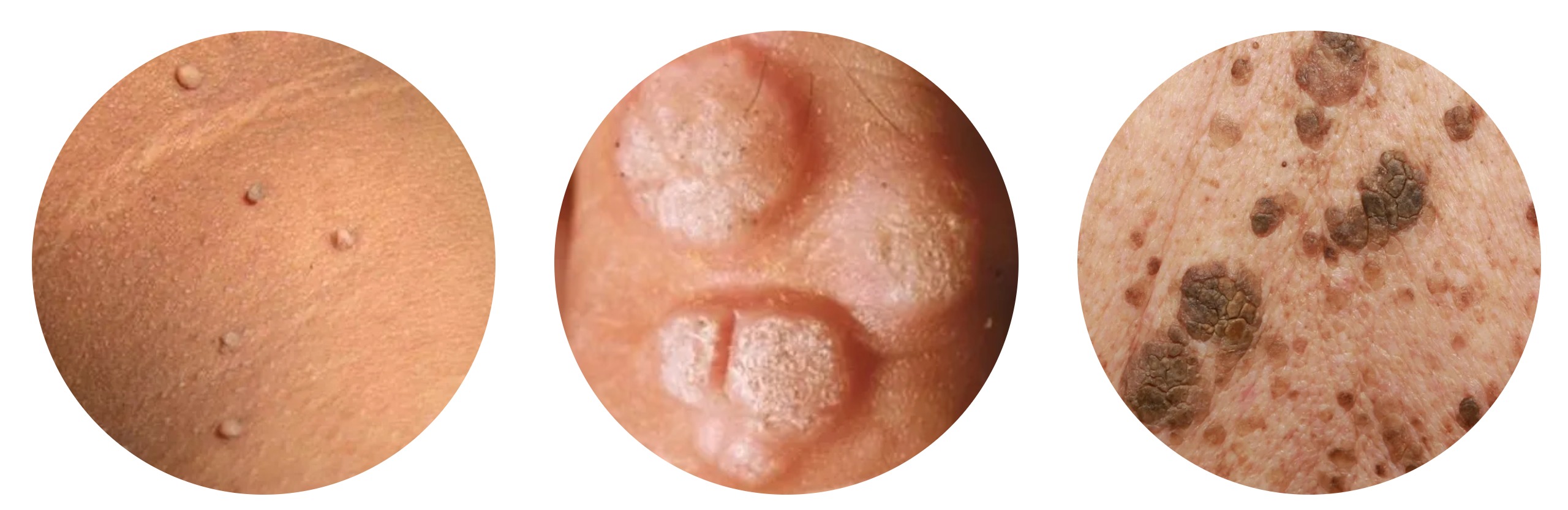 المرهم الاول في العالم لازالة الثآليل🌟 (نسخة) Xf7j0KJjxjj11k9dSrd3ECDaOGHVhWXtz4GcQ4cx