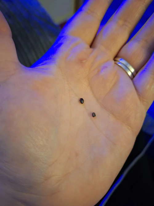 جهاز إزالة الثآليل بكل سهولة - بدون نزيف و لا ندوب و لا ألم 🌟🌟 CKIrpIh7f3OhVO4dbUCd16KeUeo85fTFs5kByaNn