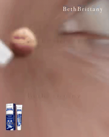 المرهم الاول في العالم لازالة الثآليل🌟 (نسخة) S2roytkFiDLMHmG5paJyioI0nUPy5GYSDtTTjtVE