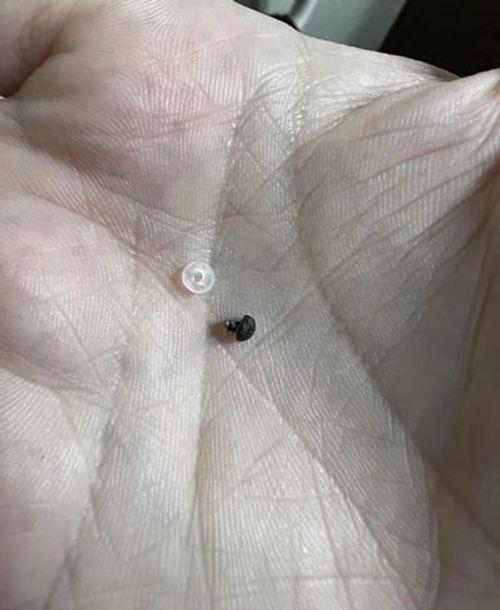 جهاز إزالة الثآليل بكل سهولة - بدون نزيف و لا ندوب و لا ألم 🌟🌟 SVlzeJgnSZEmVTNNwOIQQySsWwOskFZBniLVDqgn