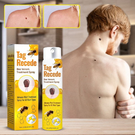 سم النحل الأصلي لعلاج الشامات و التاليل