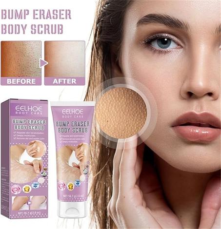 ClearSkin™ KP Body Scrub