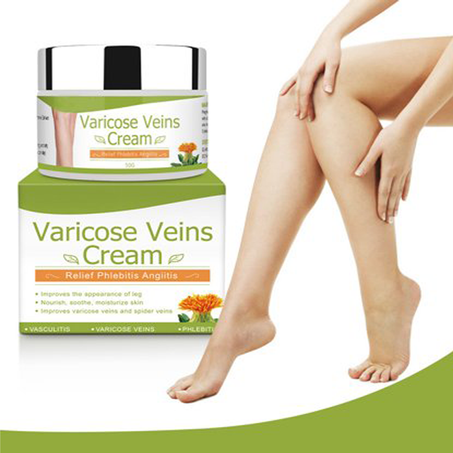 كريم تخفيف دوالي الاوردة - Varicose Veins Cream