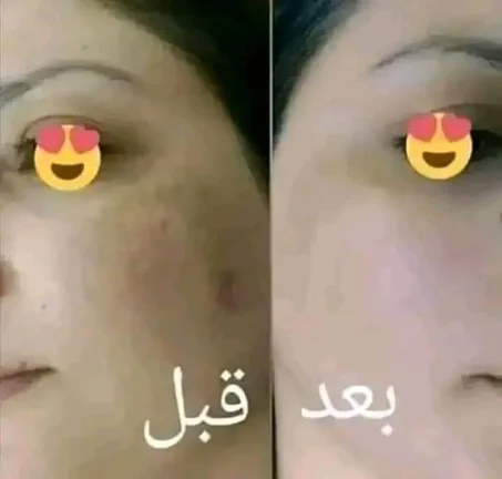 كلينيك كلير