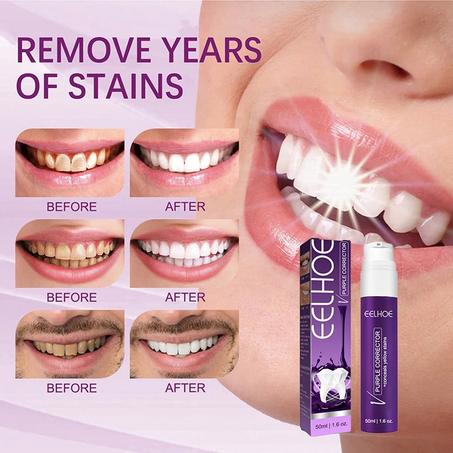 Purple Whitening Toothpaste | معجون أسنان أرجواني لتبييض الأسنان