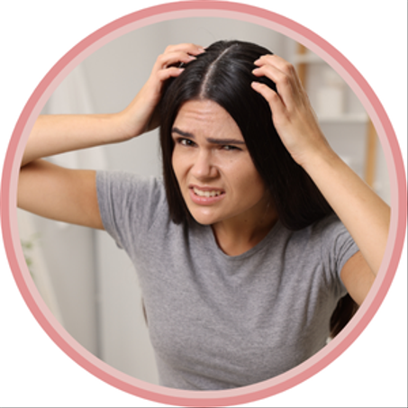 القشرة ومشاكل فروة الرأس