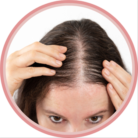 بطء نمو الشعر والفراغات