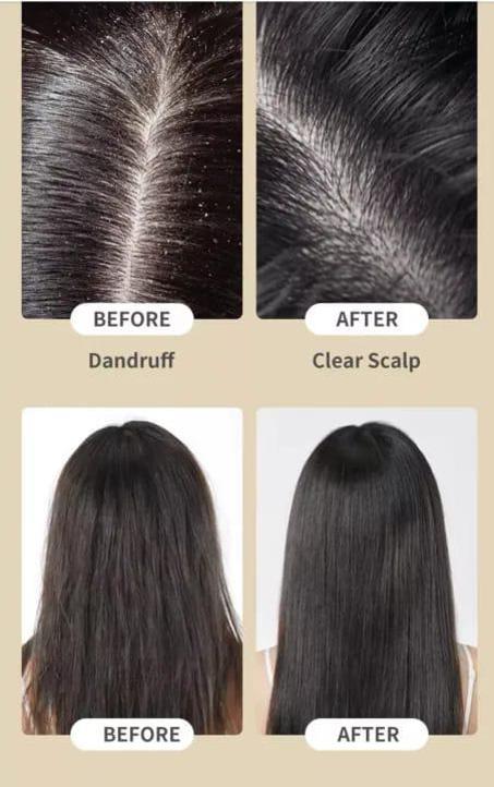 شامبو وبلسم ياباني ساكورا رقم 1