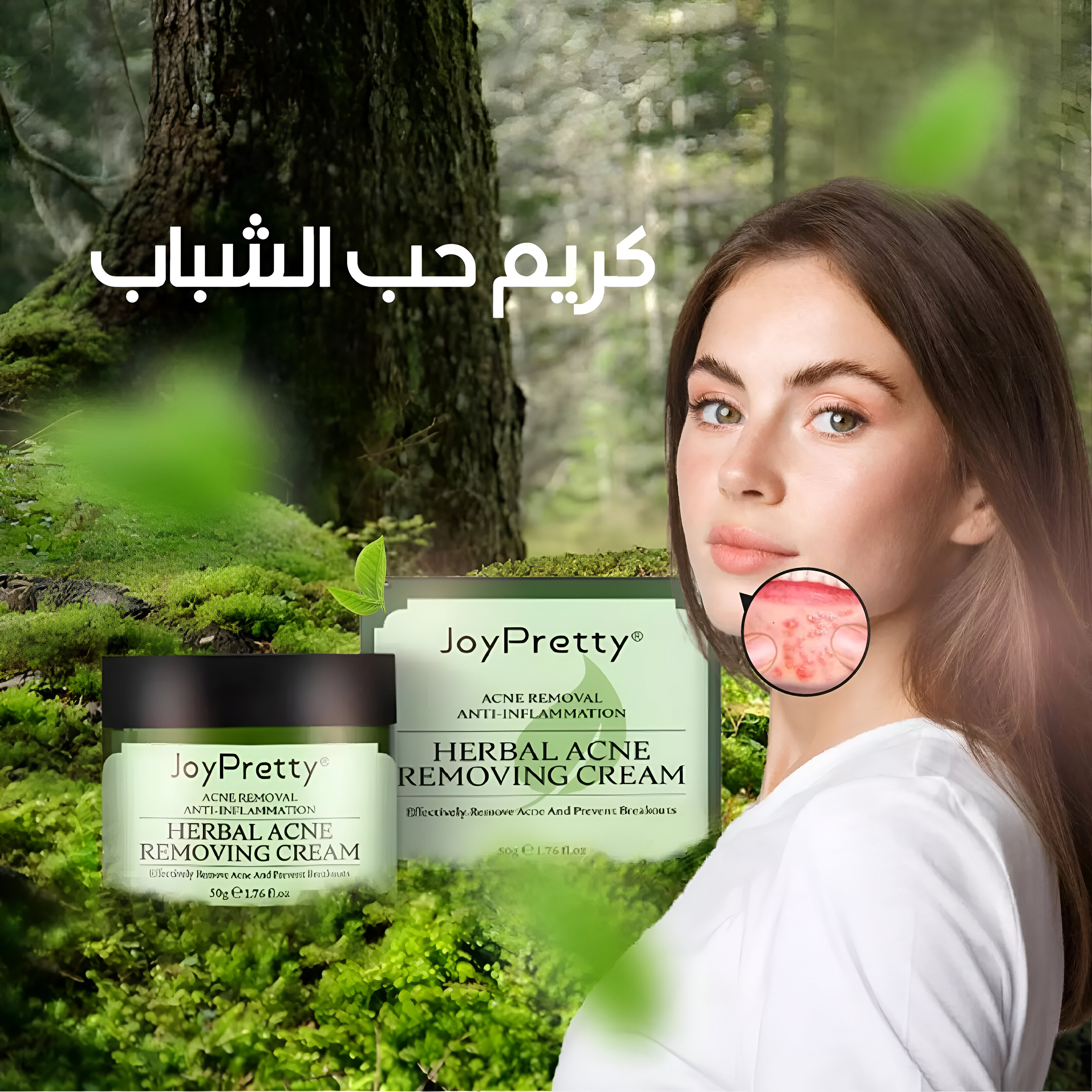 Face Acne Cream