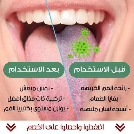 سيروم طبيعي للتخلص من رائحة الفم الكريهة