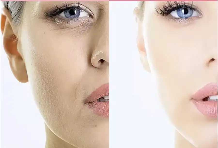 سيروم العناية بالبشرة بمستخلص الحلزون لتجديد خلايا بشرتك، تقليل التجاعيد، وتوحيد لون البشرة - novoloo