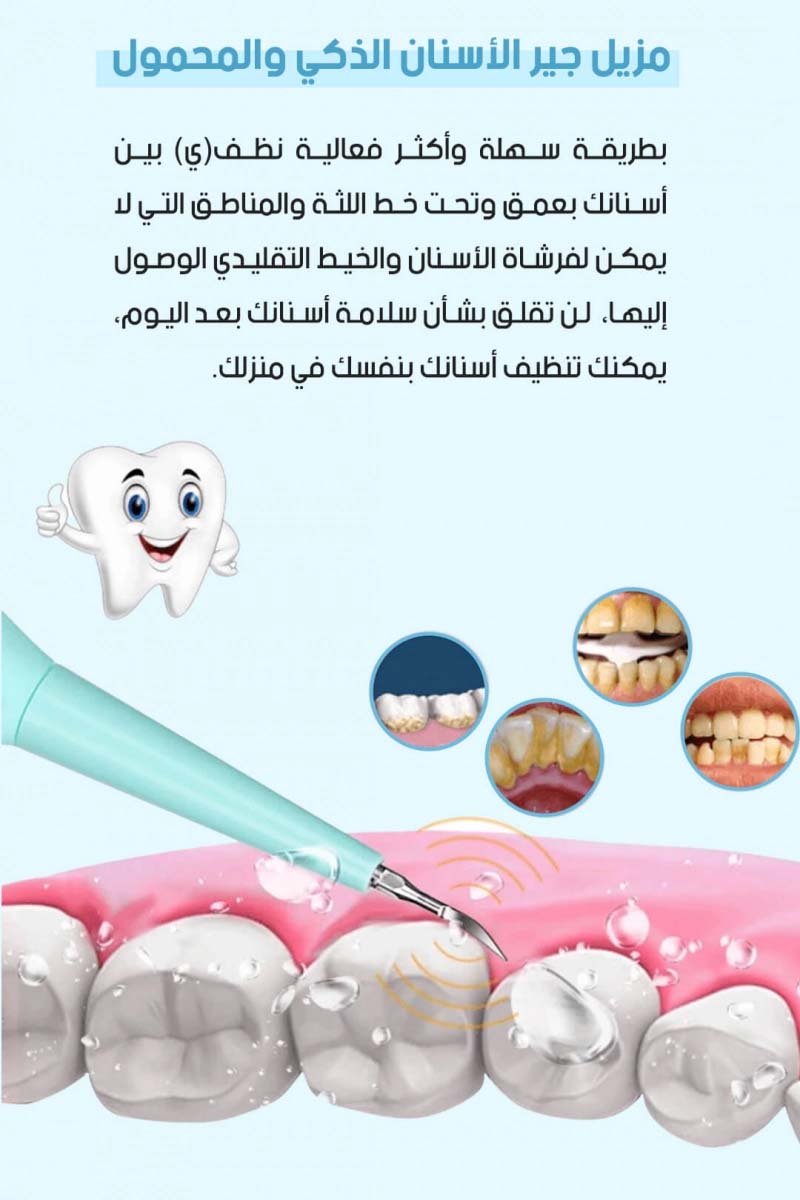 أفضل أداة لإزالة جير الاسنان وتنظيف الاسنان من الكلس، للحصول على اسنان بيضاء في المنزل. مزيل جير الاسنان الذكي والمحمول لتنظيف الاسنان في كل مكان وزمان - novoloo