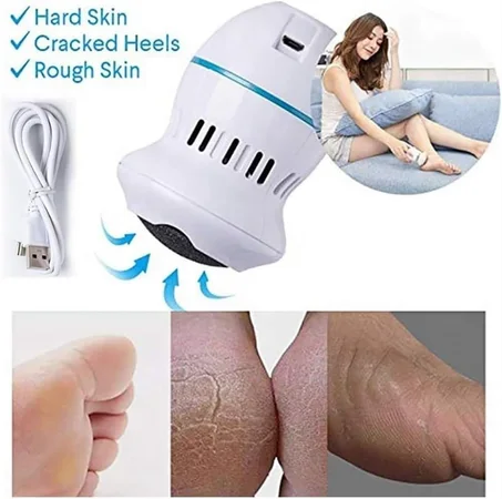 ماكينة إزالة الجلد الميت هي جهاز كهربائي  Dead Skin Removal Machine